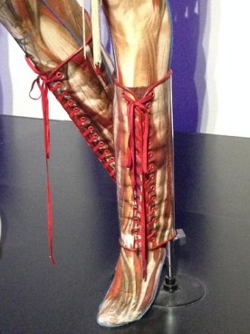 IMG201581111217942924